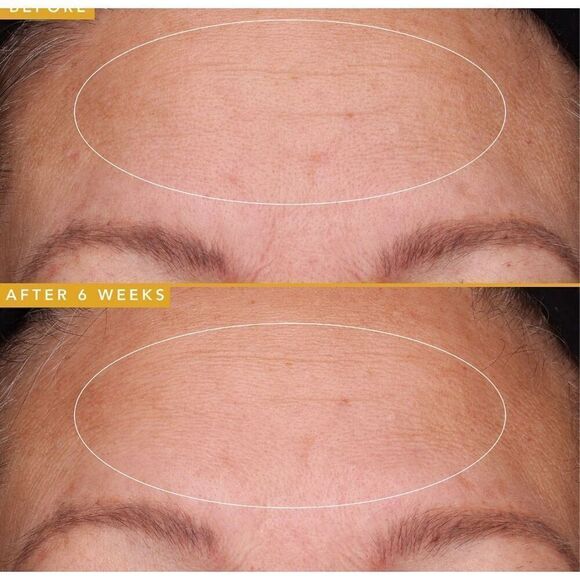 Farmacy Filling Good Hyaluronic Acid Plumping Anti Wrinkle Serum 30 ml - Picture 3 of 8